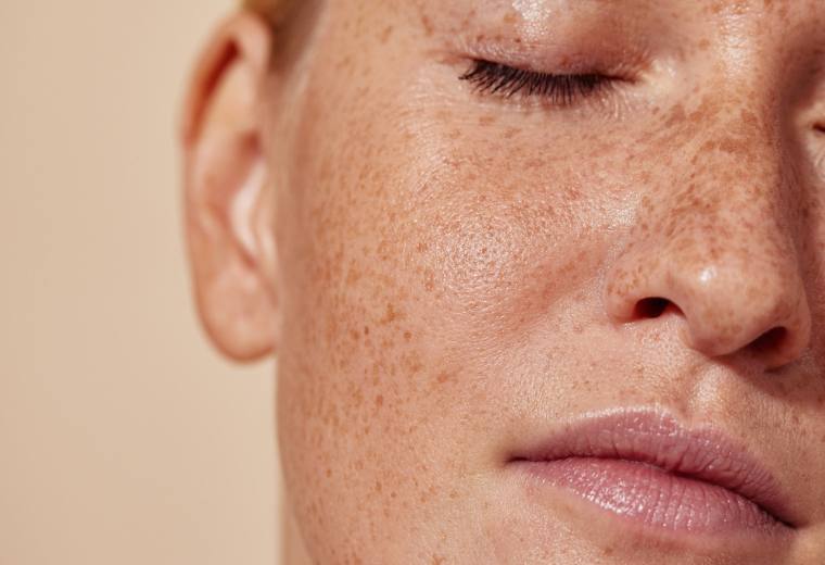 General skin condition visit